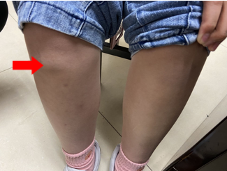 少儿运动操_少儿运动项目有哪些_运动少儿