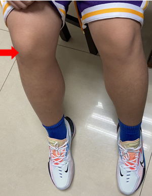 运动少儿_少儿运动项目有哪些_少儿运动操